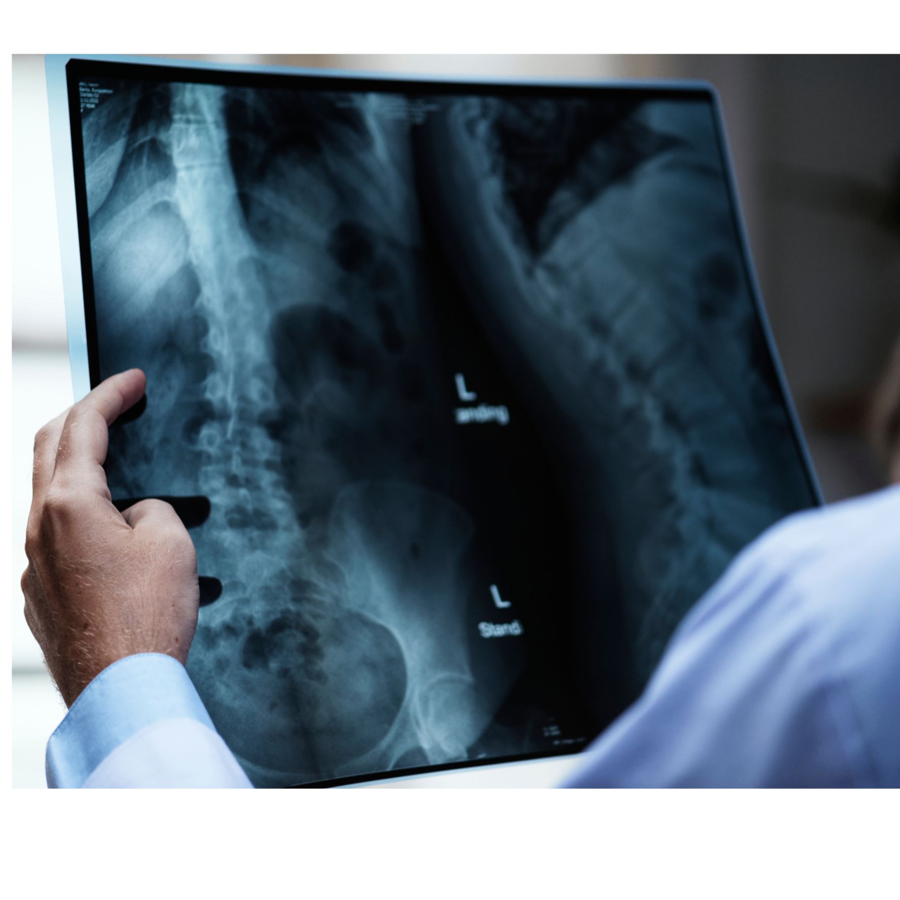 Spine Surgeon